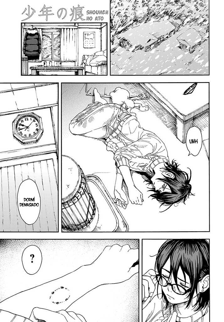 A Boy's Scar Especial 第17页