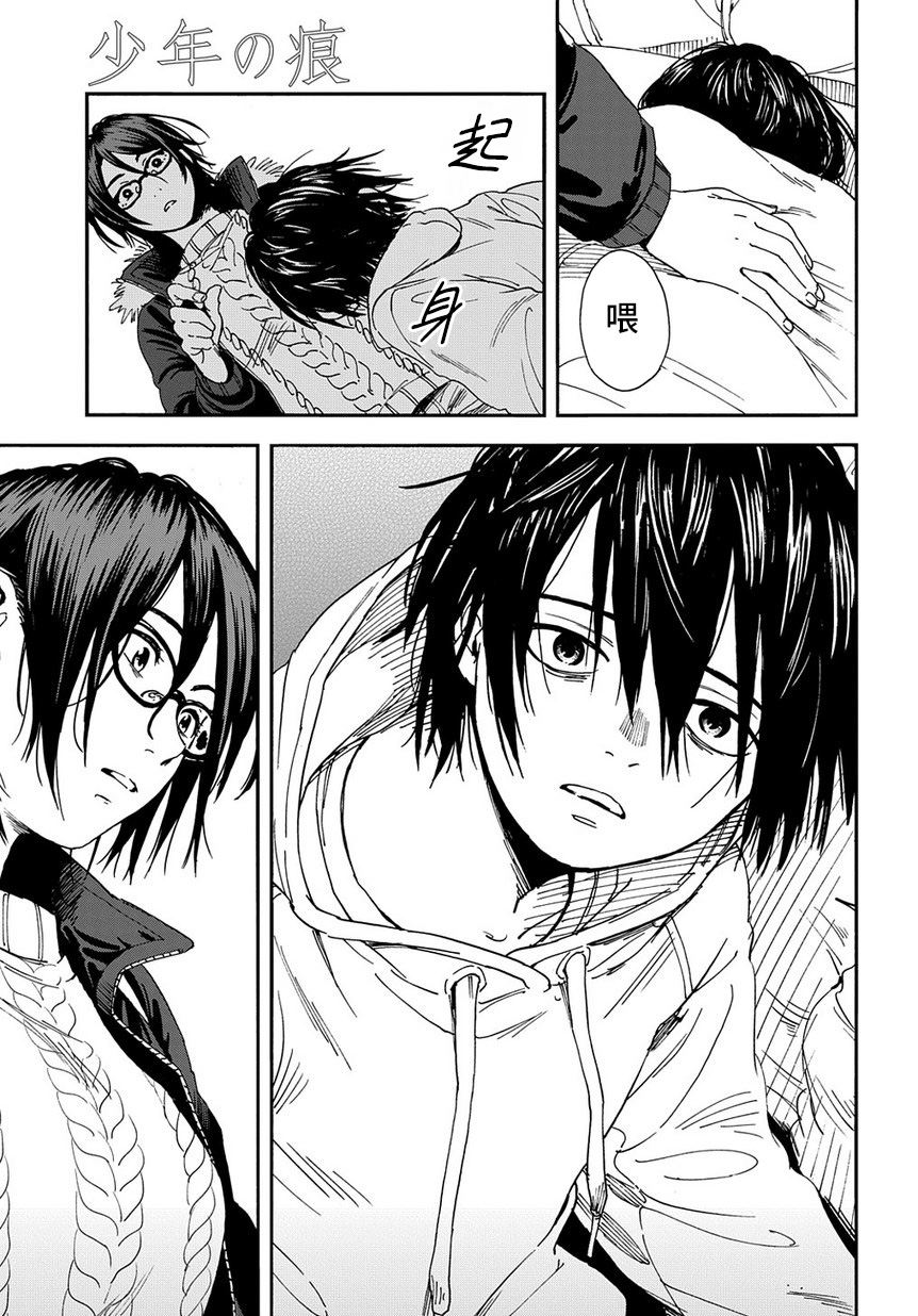 A Boy's Scar 第8页