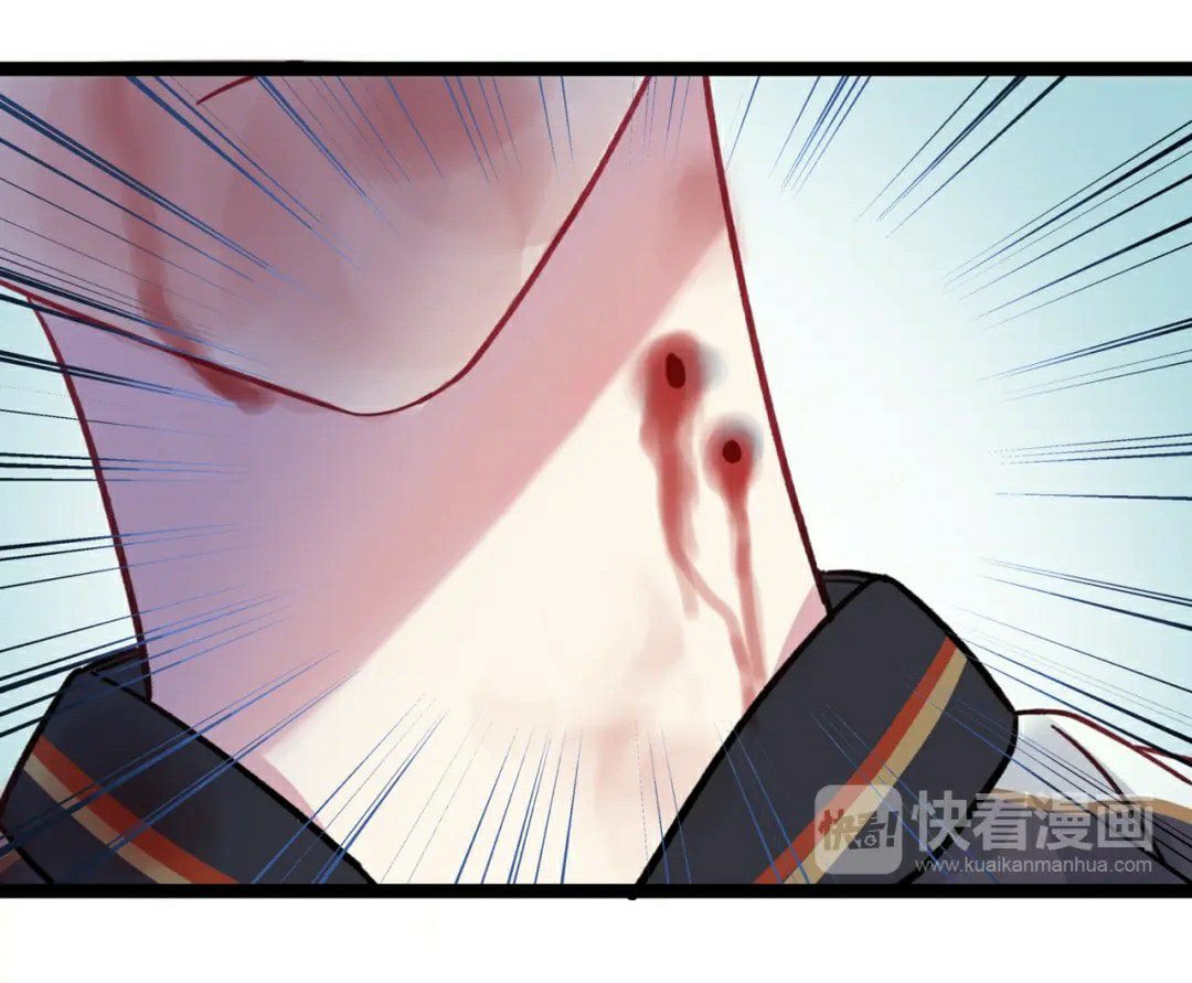 Blood Lovers Ch. 2 第11页